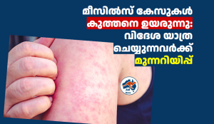 മീസിൽസ് കേസുകൾ കുത്തനെ ഉയരുന്നു: വിദേശ യാത്ര ചെയ്യുന്നവർക്ക് മുന്നറിയിപ്പ്