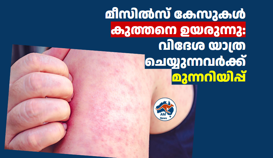 മീസിൽസ് കേസുകൾ കുത്തനെ ഉയരുന്നു: വിദേശ യാത്ര ചെയ്യുന്നവർക്ക് മുന്നറിയിപ്പ്